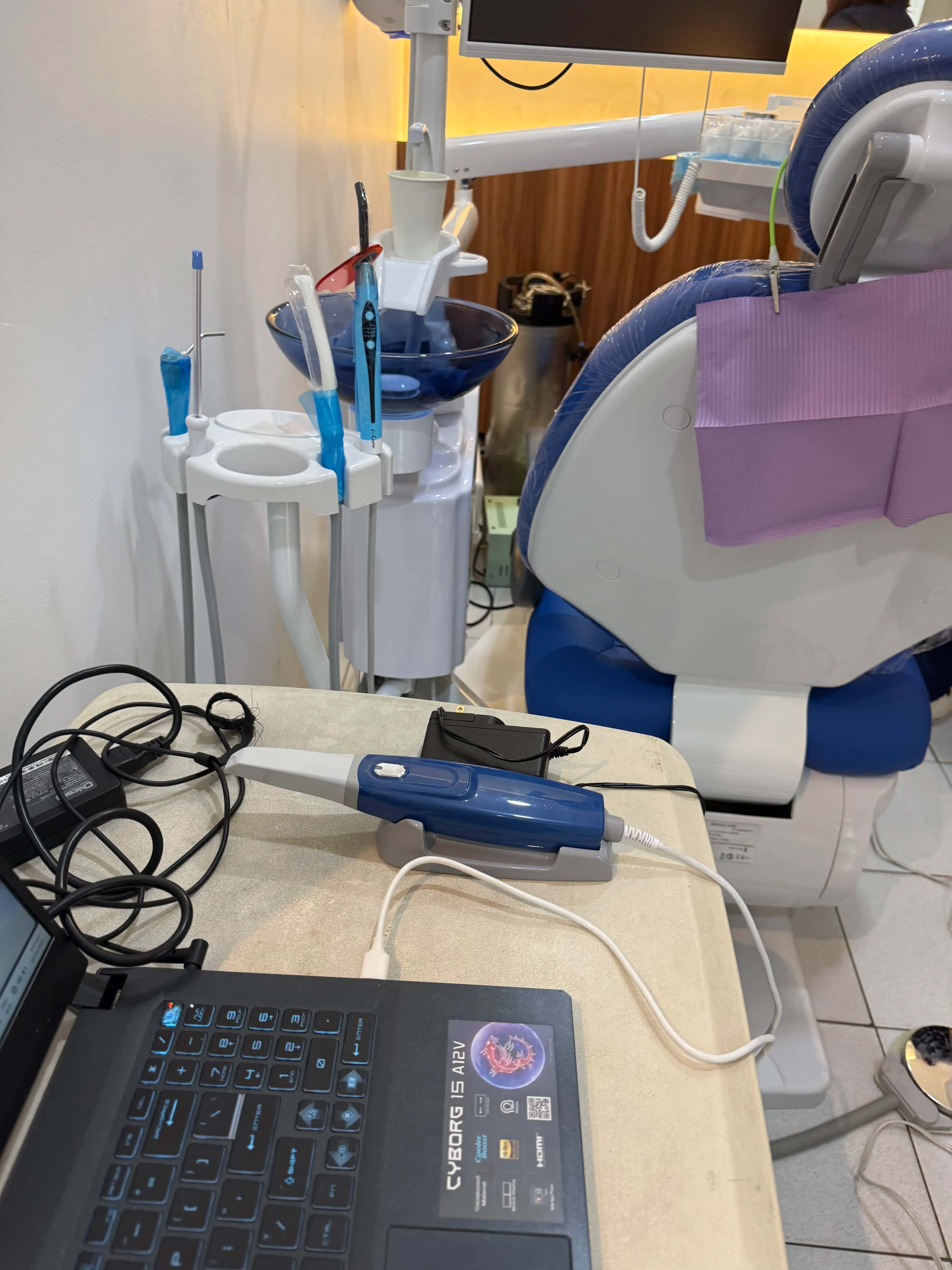 3D Intraoral Scanner thumbnail 2