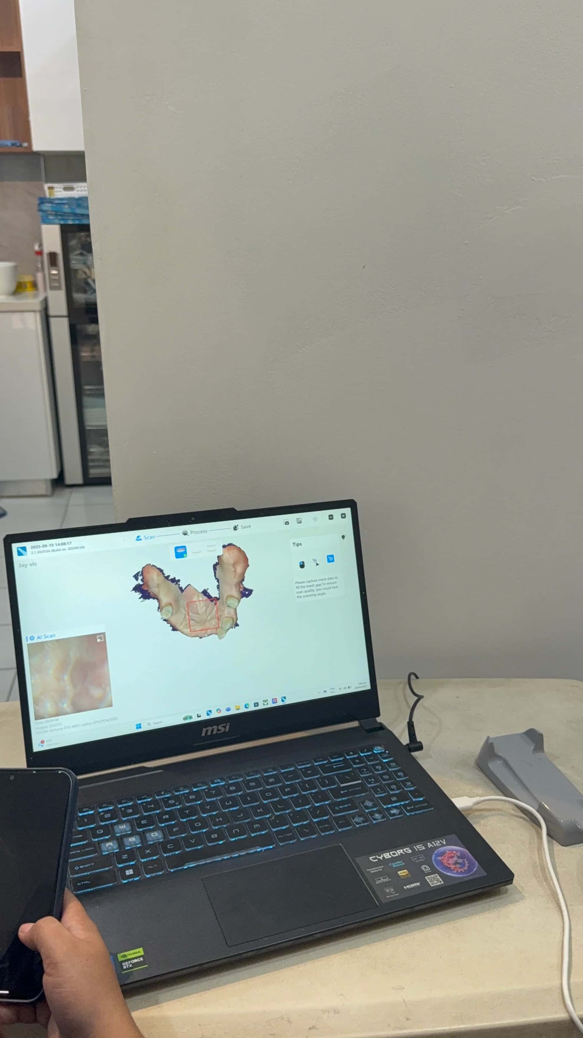 3D Intraoral Scanner thumbnail 7