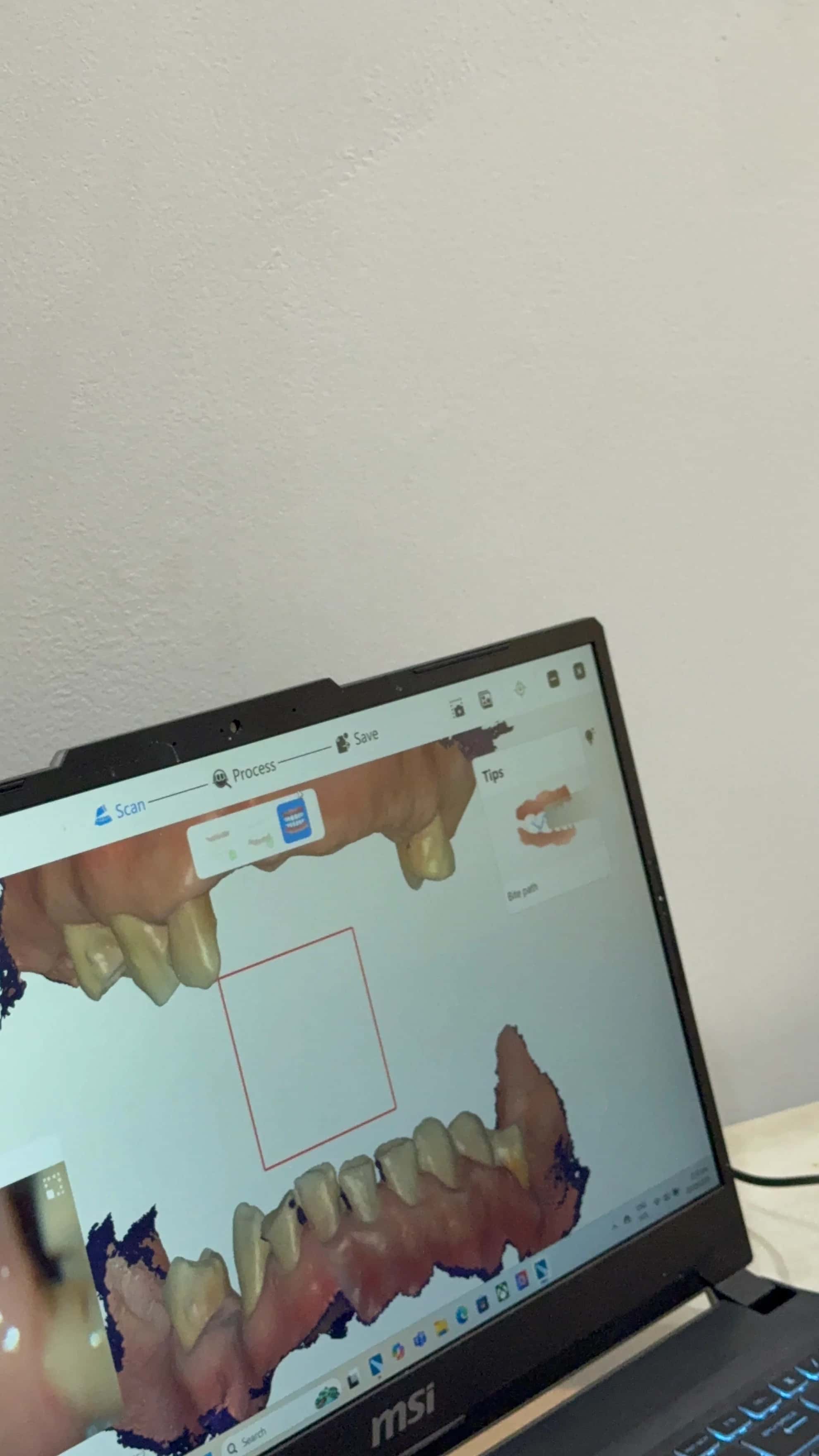 3D Intraoral Scanner thumbnail 8