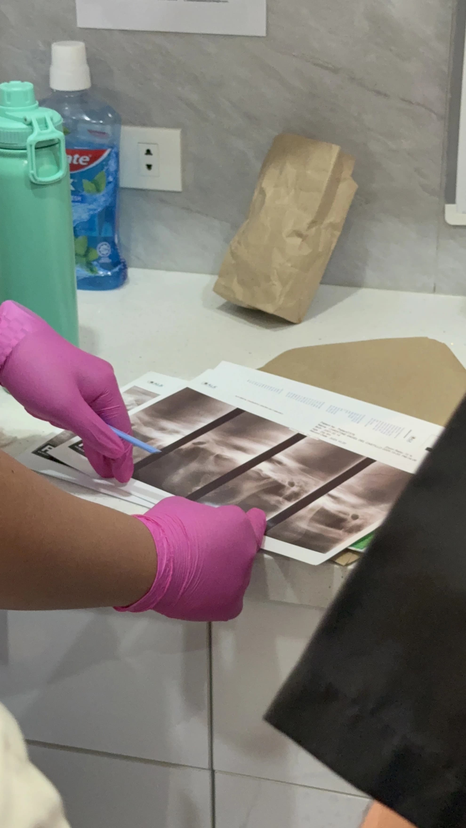 TMJ treatment evaluation at Legacy Smiles